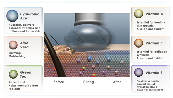 Rejuvenate Treatment