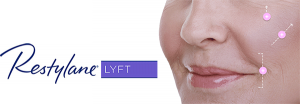 restylane lyft corona ca