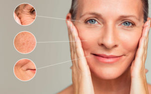 wrinkle treatments corona ca