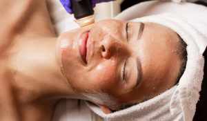 The ultimate facial treatment