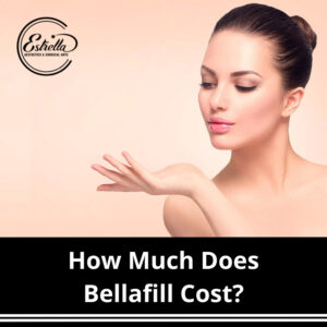 How Much Does Bellafill Cost?