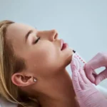 Botox-by-Estrella-Aesthetics-S-Corp-in-Corona-Ca