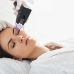 Eye-Rejuvenation-in-Corona-CA-estrella-aesthetics-and-surgical-arts