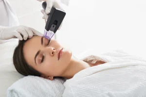 Eye-Rejuvenation-in-Corona-CA-estrella-aesthetics-and-surgical-arts