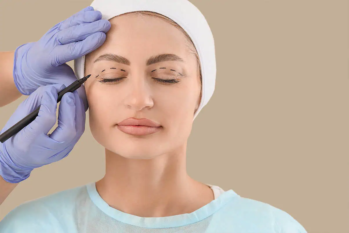 Eyelid-Surgery