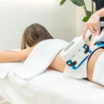 Fat-Reduction-in-Corona-Ca-in-Estrella-Aesthetic-and-Surgical-Arts