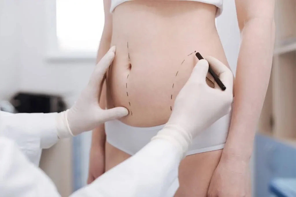 Fat-Transfer-in-Corona-Ca-in-Estrella-Aesthetics-and-Surgical-Arts-Two