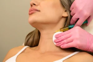 Mid-Face-Neck-Lift-treatment-in-Coronorn-a-Ca-Estrella-Aesthetics-and-Surgical-Arts