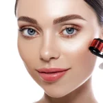 RF-Microneedling-treatment-in-Corona-Ca-Estrella-Aesthetics-and-Surgical-Arts