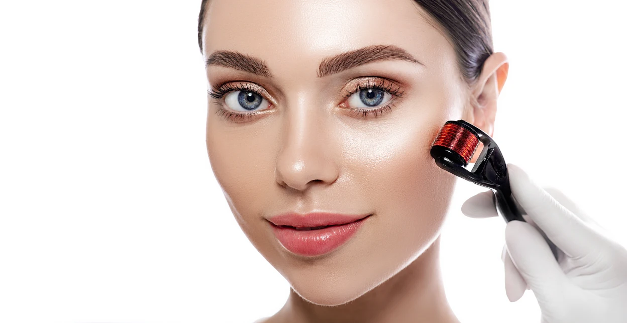 RF-Microneedling-treatment-in-Corona-Ca-Estrella-Aesthetics-and-Surgical-Arts