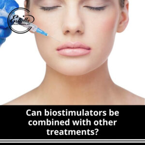 Can biostimulators be combined with other treatments?
