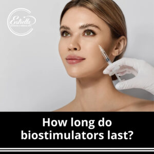 How long do biostimulators last?