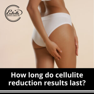 How long do cellulite reduction results last?