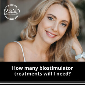 How many biostimulator treatments will I need?