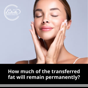 How much of the transferred fat will remain permanently?