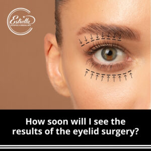 How soon will I see the results of the eyelid surgery?
