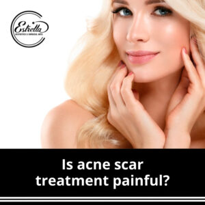 Is acne scar treatment painful?