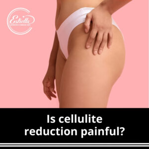 Is cellulite reduction painful?