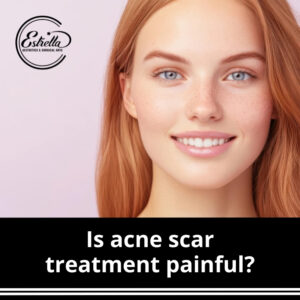 When will I see the results of the acne scar treatment?