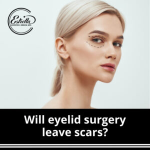 Will eyelid surgery leave scars?