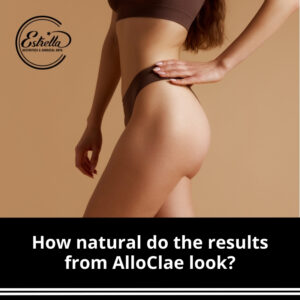 How natural do the results from AlloClae look?