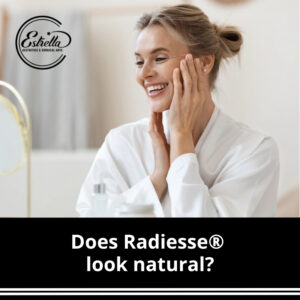 Does Radiesse® look natural?