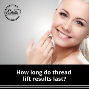 How long do thread lift results last?