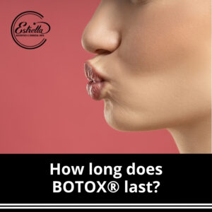 How long does BOTOX® last?
