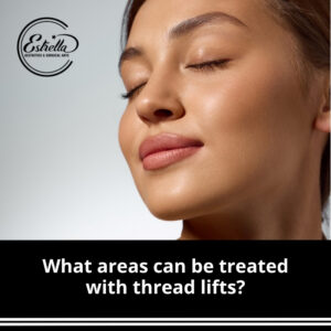 What areas can be treated with thread lifts?