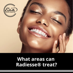 What areas can Radiesse® treat?