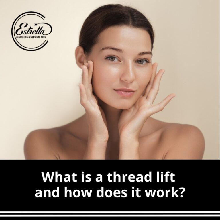 What is a thread lift and how does it work? - Estrella Aesthetics ...