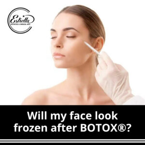 Will my face look frozen after BOTOX®?